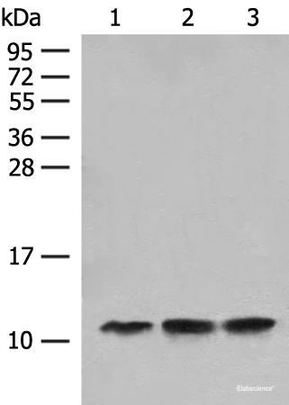 Western blot analysis of Human fetal liver tissue Hela cell HEPG2 cell lysates  using ATP5L Polyclonal Antibody at dilution of 1:500