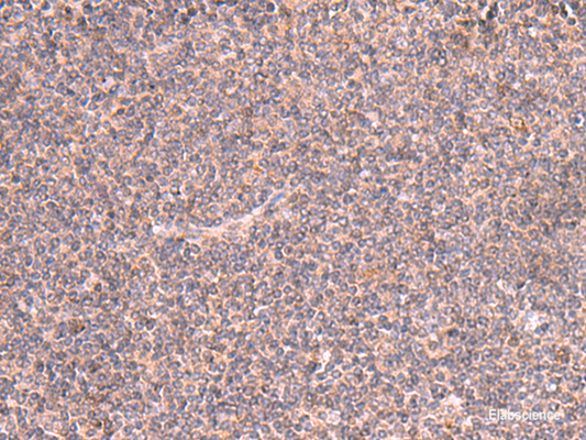 Immunohistochemistry of paraffin-embedded Human tonsil tissue  using MRPS24 Polyclonal Antibody at dilution of 1:90(×200)