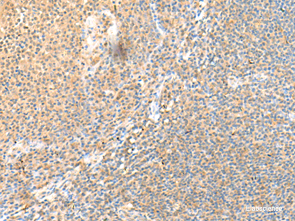 Immunohistochemistry of paraffin-embedded Human tonsil tissue  using SSC4D Polyclonal Antibody at dilution of 1:70(×200)