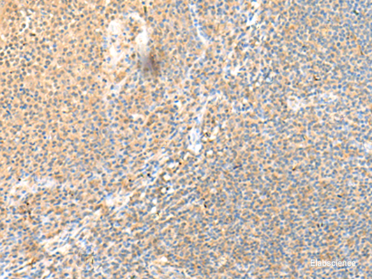 Immunohistochemistry of paraffin-embedded Human tonsil tissue  using SSC4D Polyclonal Antibody at dilution of 1:70(×200)