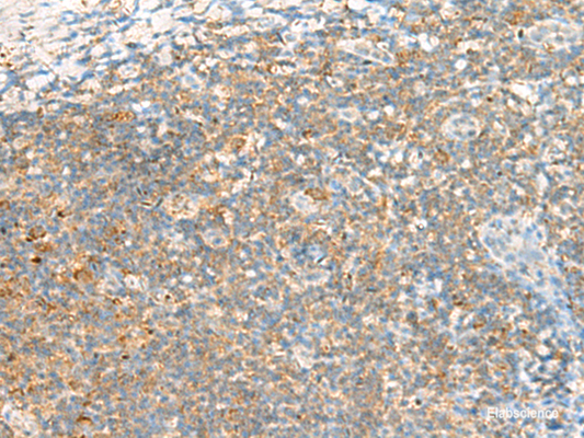 Immunohistochemistry of paraffin-embedded Human tonsil tissue  using TTLL1 Polyclonal Antibody at dilution of 1:60(×200)