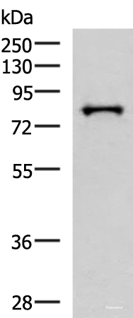 Western blot analysis of HepG2 cell lysate  using PRPF3 Polyclonal Antibody at dilution of 1:2000