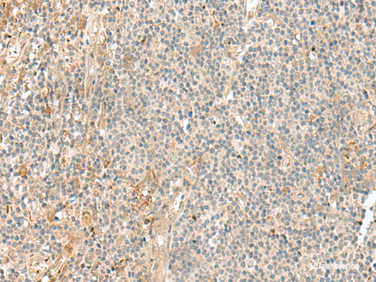 Immunohistochemistry of paraffin-embedded Human tonsil tissue  using NGEF Polyclonal Antibody at dilution of 1:35(×200)
