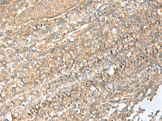 Immunohistochemistry of paraffin-embedded Human tonsil tissue  using NID2 Polyclonal Antibody at dilution of 1:70(×200)