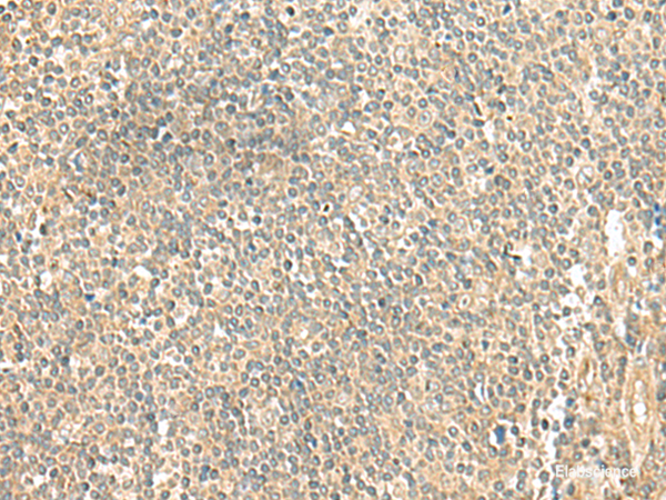 Immunohistochemistry of paraffin-embedded Human tonsil tissue  using LMO3 Polyclonal Antibody at dilution of 1:50(×200)