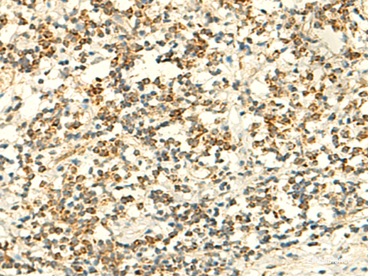 Immunohistochemistry of paraffin-embedded Human tonsil tissue  using IFT27 Polyclonal Antibody at dilution of 1:50(×200)
