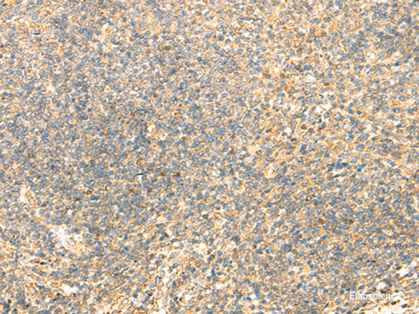 Immunohistochemistry of paraffin-embedded Human tonsil tissue  using DHFR Polyclonal Antibody at dilution of 1:50(×200)