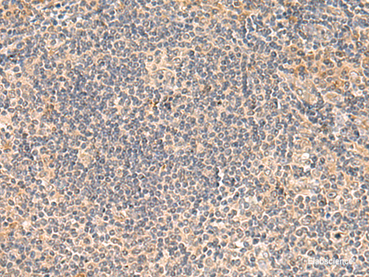 Immunohistochemistry of paraffin-embedded Human tonsil tissue  using FUNDC2 Polyclonal Antibody at dilution of 1:50(×200)