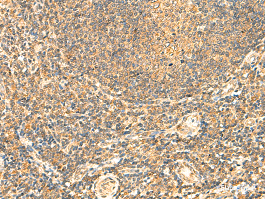 Immunohistochemistry of paraffin-embedded Human tonsil tissue  using LYZL1 Polyclonal Antibody at dilution of 1:50(×200)