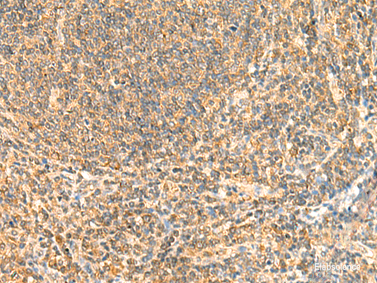 Immunohistochemistry of paraffin-embedded Human tonsil tissue  using ZNF581 Polyclonal Antibody at dilution of 1:50(×200)