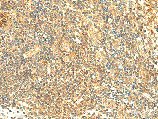 Immunohistochemistry of paraffin-embedded Human tonsil tissue  using ARL4D Polyclonal Antibody at dilution of 1:50(×200)