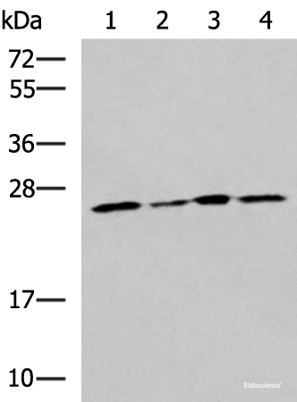 Western blot analysis of LOVO Hela A549 and HT29 cell lysates  using RPL13A Polyclonal Antibody at dilution of 1:1600