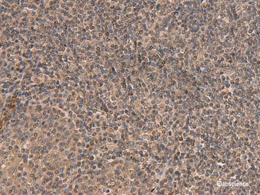 Immunohistochemistry of paraffin-embedded Human tonsil tissue  using HEBP2 Polyclonal Antibody at dilution of 1:70(×200)