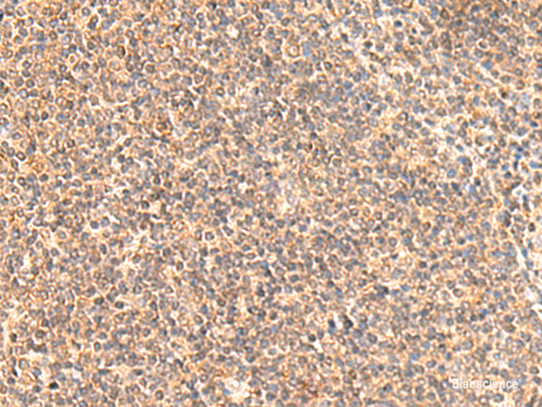 Immunohistochemistry of paraffin-embedded Human tonsil tissue  using MOB1A Polyclonal Antibody at dilution of 1:50(×200)