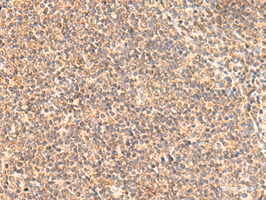 Immunohistochemistry of paraffin-embedded Human tonsil tissue  using MOB1A Polyclonal Antibody at dilution of 1:50(×200)