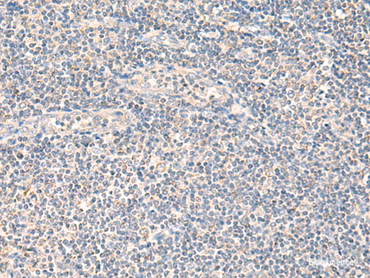 Immunohistochemistry of paraffin-embedded Human tonsil tissue  using NEGR1 Polyclonal Antibody at dilution of 1:90(×200)