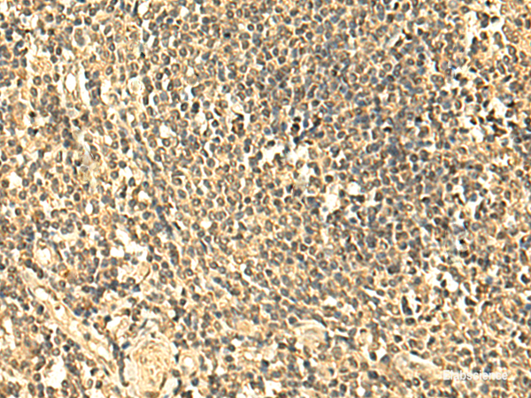 Immunohistochemistry of paraffin-embedded Human tonsil tissue  using UNKL Polyclonal Antibody at dilution of 1:50(×200)
