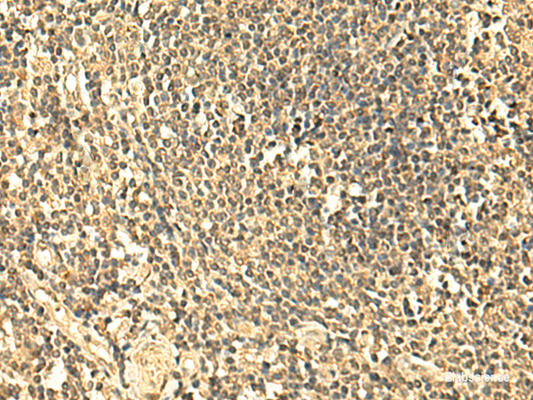 Immunohistochemistry of paraffin-embedded Human tonsil tissue  using UNKL Polyclonal Antibody at dilution of 1:50(×200)