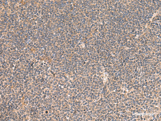 Immunohistochemistry of paraffin-embedded Human tonsil tissue  using KCNE3 Polyclonal Antibody at dilution of 1:55(×200)