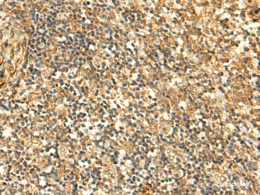 Immunohistochemistry of paraffin-embedded Human tonsil tissue  using GLYATL2 Polyclonal Antibody at dilution of 1:50(×200)