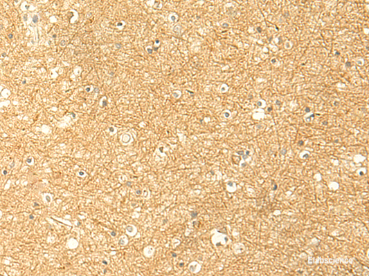 Immunohistochemistry of paraffin-embedded Human brain tissue  using RNF148 Polyclonal Antibody at dilution of 1:50(×200)