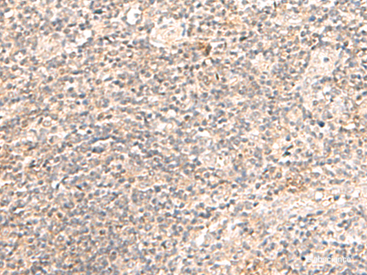 Immunohistochemistry of paraffin-embedded Human tonsil tissue  using TRAPPC1 Polyclonal Antibody at dilution of 1:50(×200)