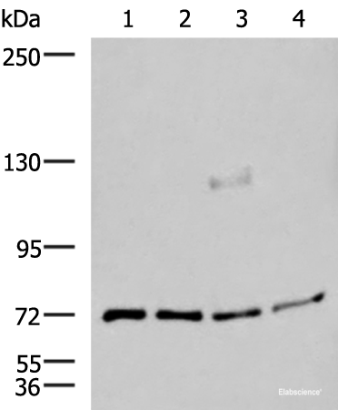 Western blot analysis of A549 A172 TM4 and PC3 cell lysates  using ASTE1 Polyclonal Antibody at dilution of 1:600