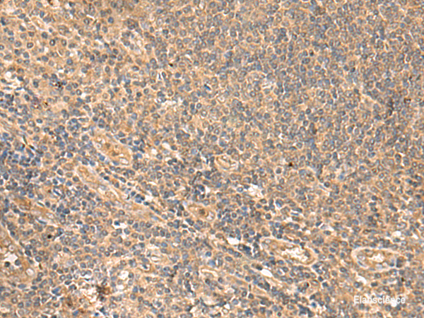 Immunohistochemistry of paraffin-embedded Human tonsil tissue  using MEST Polyclonal Antibody at dilution of 1:65(×200)