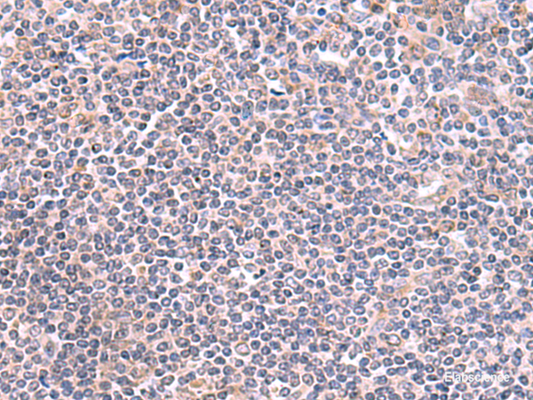Immunohistochemistry of paraffin-embedded Human tonsil tissue  using GMDS Polyclonal Antibody at dilution of 1:70(×200)