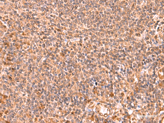 Immunohistochemistry of paraffin-embedded Human tonsil tissue  using RABEPK Polyclonal Antibody at dilution of 1:85(×200)
