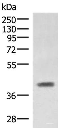Western blot analysis of Mouse liver tissue lysate  using SAMSN1 Polyclonal Antibody at dilution of 1:1000