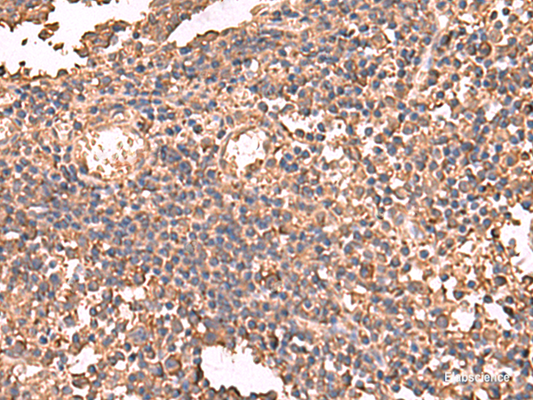 Immunohistochemistry of paraffin-embedded Human tonsil tissue  using LDHAL6B Polyclonal Antibody at dilution of 1:65(×200)