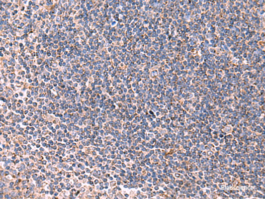Immunohistochemistry of paraffin-embedded Human tonsil tissue  using LIPA Polyclonal Antibody at dilution of 1:85(×200)