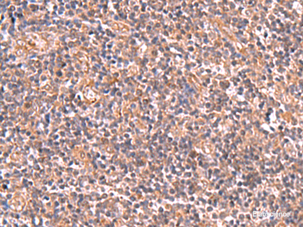 Immunohistochemistry of paraffin-embedded Human tonsil tissue  using UBAC1 Polyclonal Antibody at dilution of 1:50(×200)