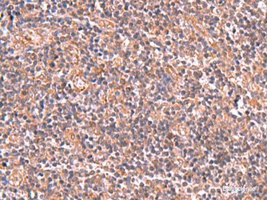Immunohistochemistry of paraffin-embedded Human tonsil tissue  using UBAC1 Polyclonal Antibody at dilution of 1:50(×200)
