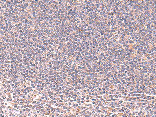 Immunohistochemistry of paraffin-embedded Human tonsil tissue  using MANSC1 Polyclonal Antibody at dilution of 1:105(×200)