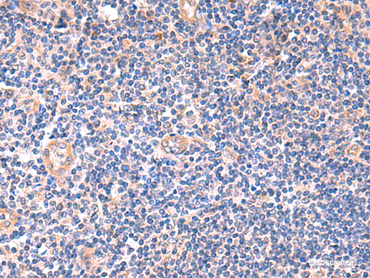 Immunohistochemistry of paraffin-embedded Human tonsil tissue  using ZNF256 Polyclonal Antibody at dilution of 1:120(×200)