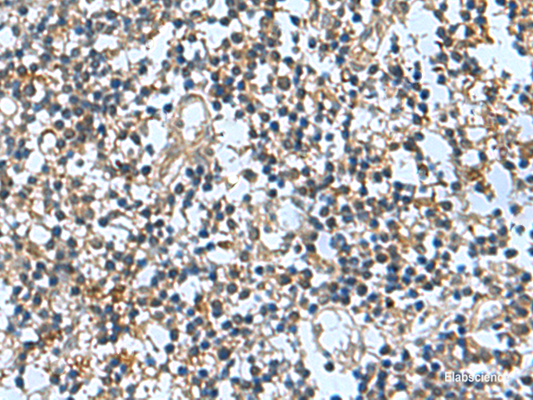 Immunohistochemistry of paraffin-embedded Human tonsil tissue  using TRO Polyclonal Antibody at dilution of 1:65(×200)