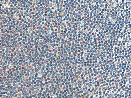 Immunohistochemistry of paraffin-embedded Human tonsil tissue  using CNTN4 Polyclonal Antibody at dilution of 1:65(×200)