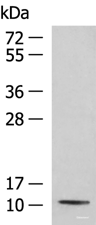 Western blot analysis of Mouse kidney tissue lysate  using PCBD1 Polyclonal Antibody at dilution of 1:800