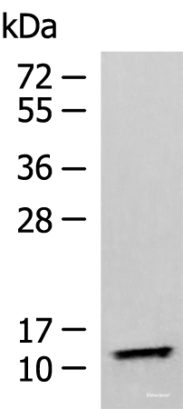 Western blot analysis of Human fetal liver tissue lysate  using TMEM141 Polyclonal Antibody at dilution of 1:900