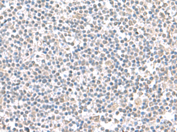 Immunohistochemistry of paraffin-embedded Human tonsil tissue  using IFI27 Polyclonal Antibody at dilution of 1:100(×200)