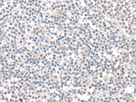 Immunohistochemistry of paraffin-embedded Human tonsil tissue  using IFI27 Polyclonal Antibody at dilution of 1:100(×200)