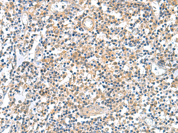Immunohistochemistry of paraffin-embedded Human tonsil tissue  using GEMIN7 Polyclonal Antibody at dilution of 1:50(×200)