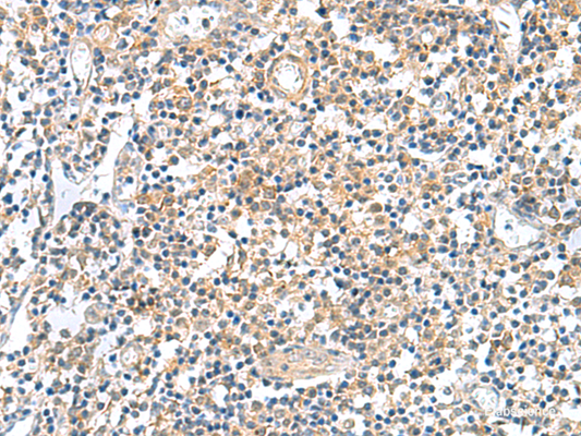 Immunohistochemistry of paraffin-embedded Human tonsil tissue  using GEMIN7 Polyclonal Antibody at dilution of 1:50(×200)