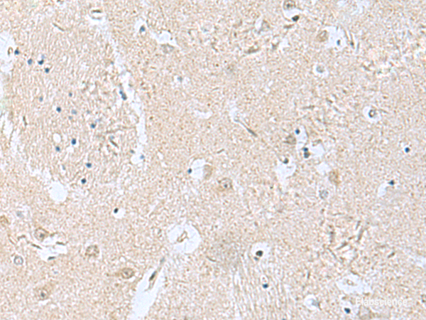 Immunohistochemistry of paraffin-embedded Human brain tissue  using TPD52L3 Polyclonal Antibody at dilution of 1:160(×200)
