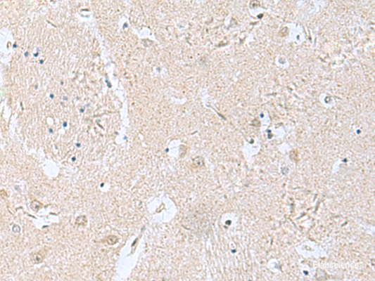 Immunohistochemistry of paraffin-embedded Human brain tissue  using TPD52L3 Polyclonal Antibody at dilution of 1:160(×200)