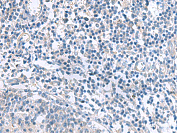 Immunohistochemistry of paraffin-embedded Human tonsil tissue  using MYL1 Polyclonal Antibody at dilution of 1:50(×200)