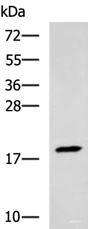 Western blot analysis of Human muscle tissue lysate  using TNNC2 Polyclonal Antibody at dilution of 1:400