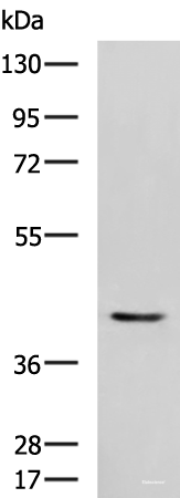 Western blot analysis of Mouse heart tissue lysate  using STK32A Polyclonal Antibody at dilution of 1:1000